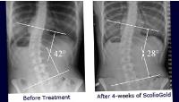 Scoliosis SOS Clinic image 6